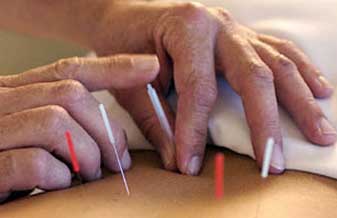 Clínica de Acupuntura Médica dra Huang Wei Ling - Foto 1